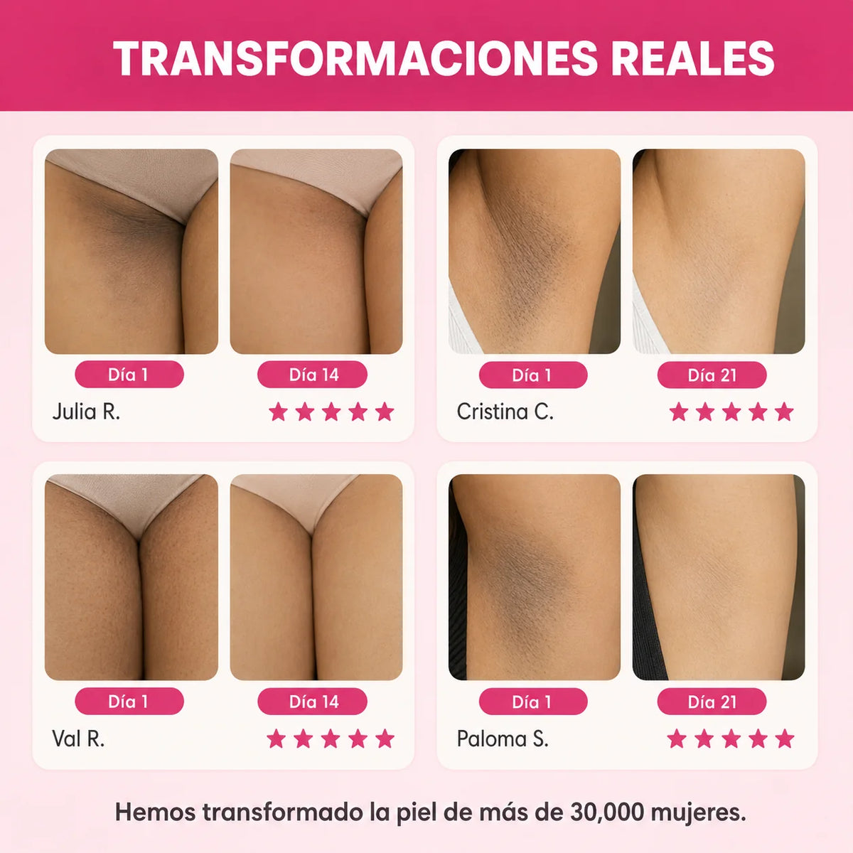 Tratamiento Aclarante Skinglow